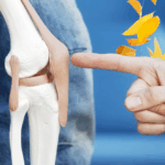 WZ5MIECZ50WI3OOMI2RZ - Thế Giới Trong Tầm Tay Ngày Gút Thế Giới: 14 Hiểu Lầm Thường Gặp Về Bệnh Gút Đã Được Làm Rõ