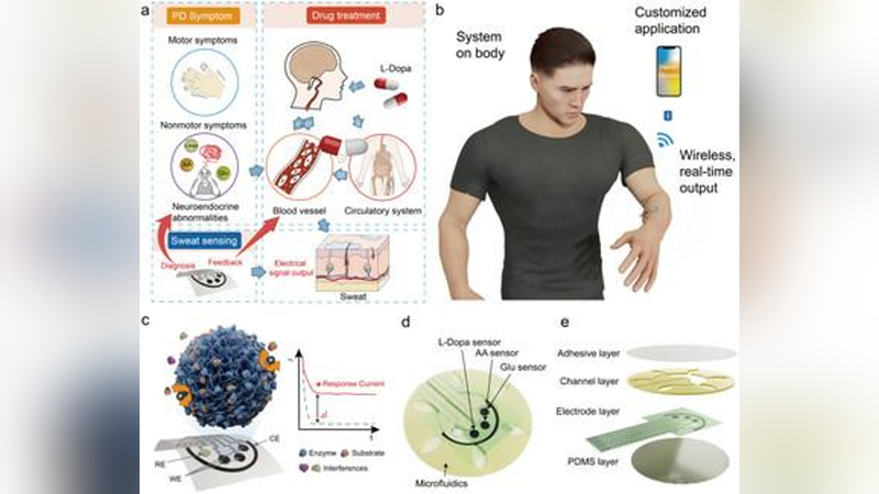 Miếng dán đeo được để phát hiện Parkinson sớm mang lại hy vọng mới Miếng dán đeo được để phát hiện Parkinson sớm mang lại hy vọng mới