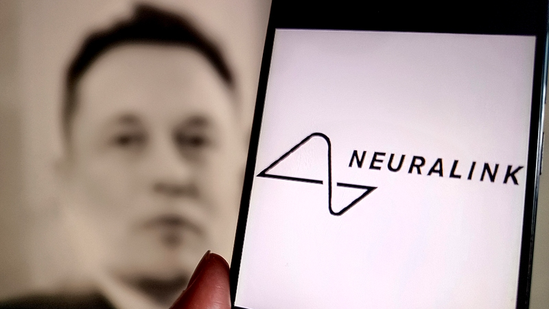 Thiết bị N1 của Neuralink mở ra công nghệ điều khiển bằng suy nghĩ Thiết bị N1 của Neuralink mở ra công nghệ điều khiển bằng suy nghĩ