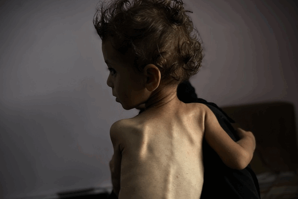 Nạn đói ở Gaza: Bên trong Địa Ngục Trần Gian của Một Thảm Hoạ Do Con Người Gây Ra Nạn đói ở Gaza: Bên trong Địa Ngục Trần Gian của Một Thảm Hoạ Do Con Người Gây Ra