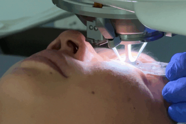 AI cách mạng hóa phẫu thuật LASIK: Nhanh hơn, An toàn hơn, Chính xác hơn video poster